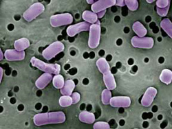 Lactobacillus bulgaricus