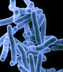 Mycobacterium tuberculosis